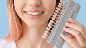 veneers