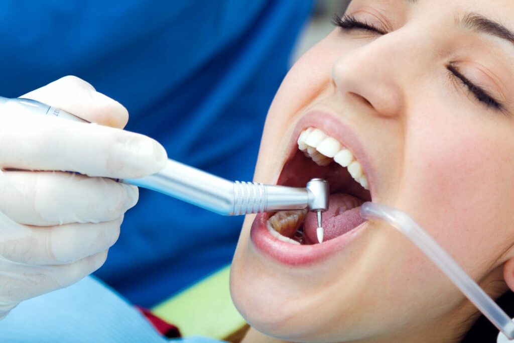 tooth fillings hampton park