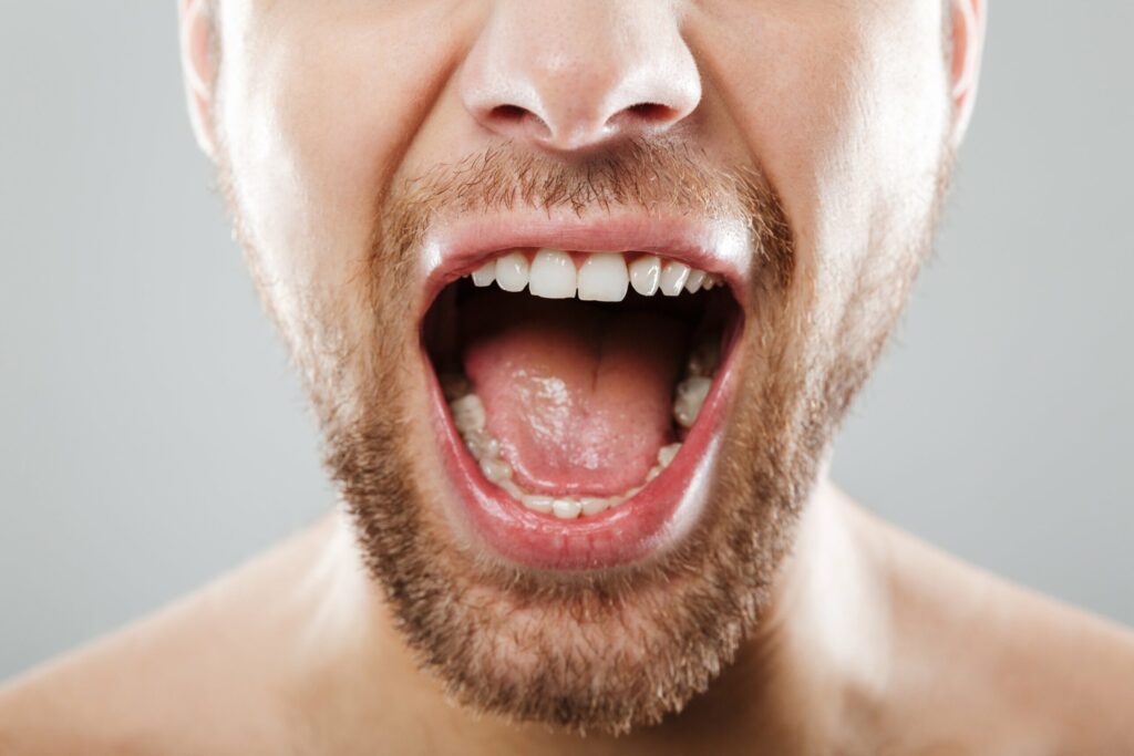 wisdom tooth extraction hampton park