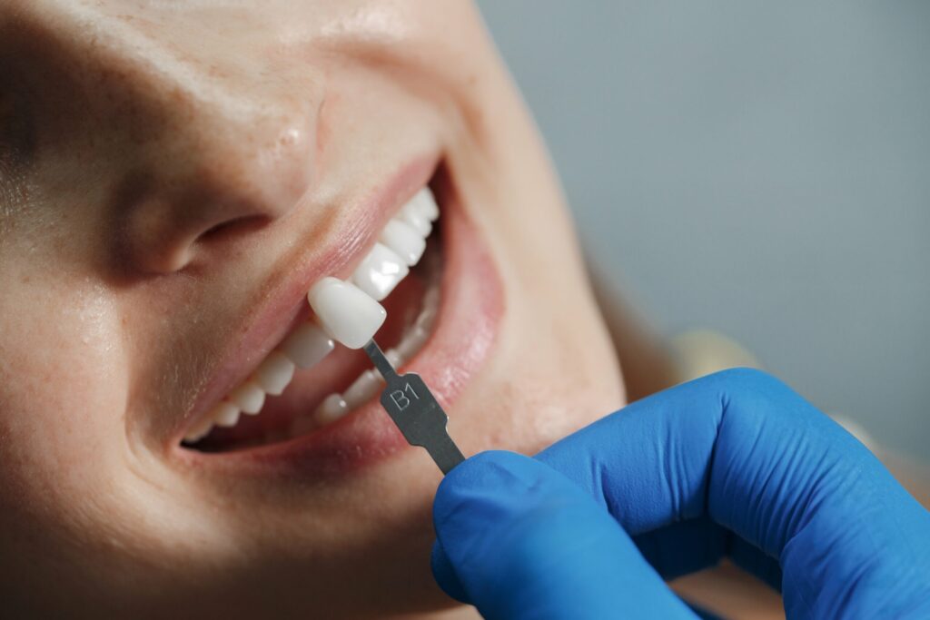 dental crowns hampton park