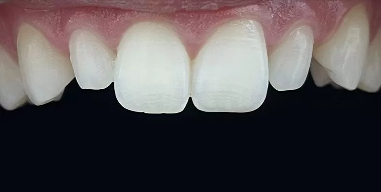 Before.jpg Before.jpg