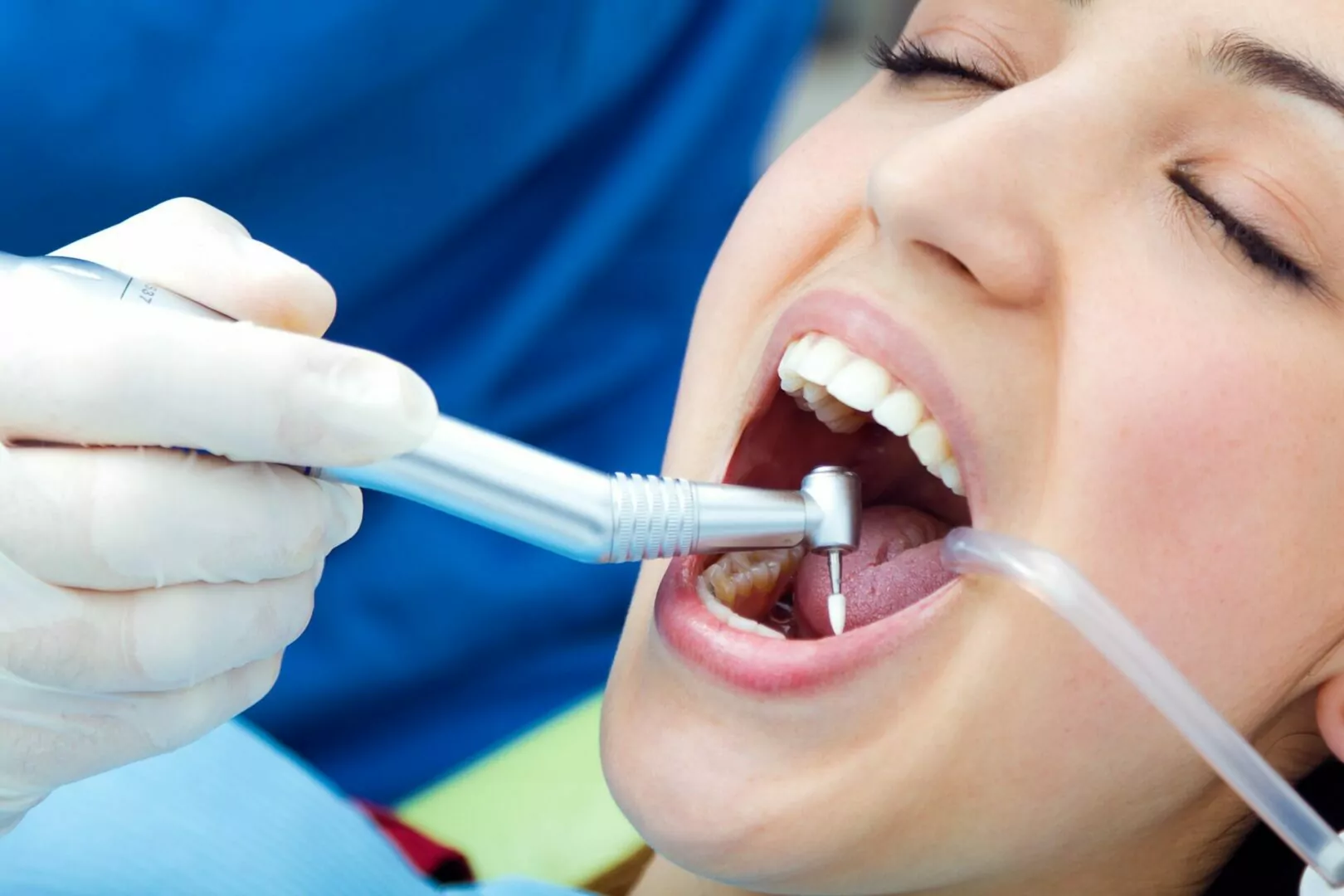 The Different Types of Tooth Fillings and Which Is Best for You